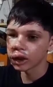 MENOR GOLPEADO