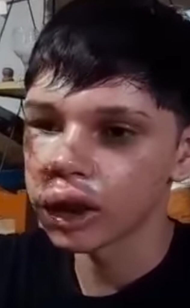 MENOR GOLPEADO